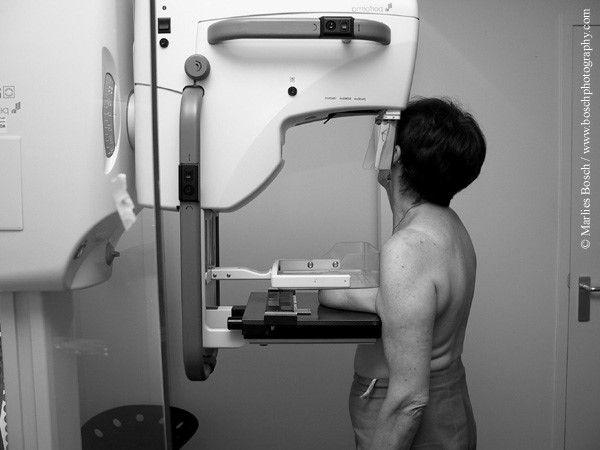 Маммографию после флюорографии. Маммограф Brestige. Рентген молочных желез маммография аппарат. Мамаогра. Маммография это исследование.